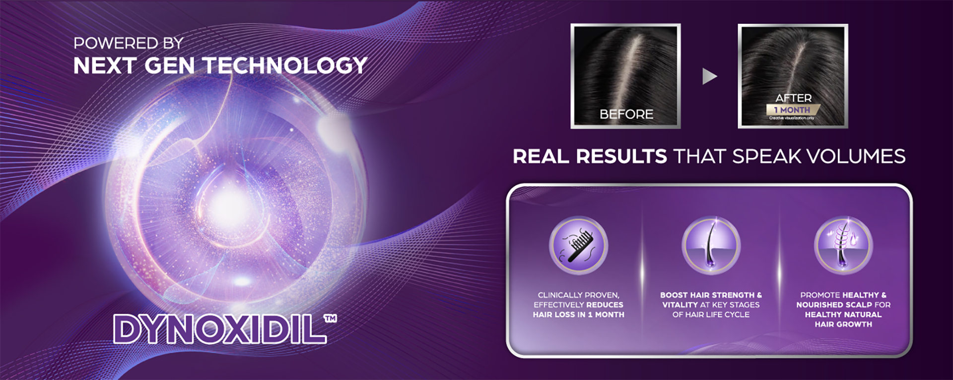 An abstract purple ‘drop’ depicting Dynoxidil with the words ‘powered by next gen technology – Dynoxidil’. On the right, a ‘before and after’ comparison highlights visible improvements in hair thickness after one month, with the words ‘real results that speak volumes’. Underneath are three illustrations: one showing a comb with broken strands of hair; the second depicting a follicle, and the third a follicle with rings around it and droplets to the sides to illustrate ‘health’.